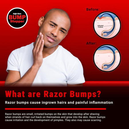 Product image 4 for High Time Bump Stopper-2 Double Strength Razor Bump Treatment, .5 oz.